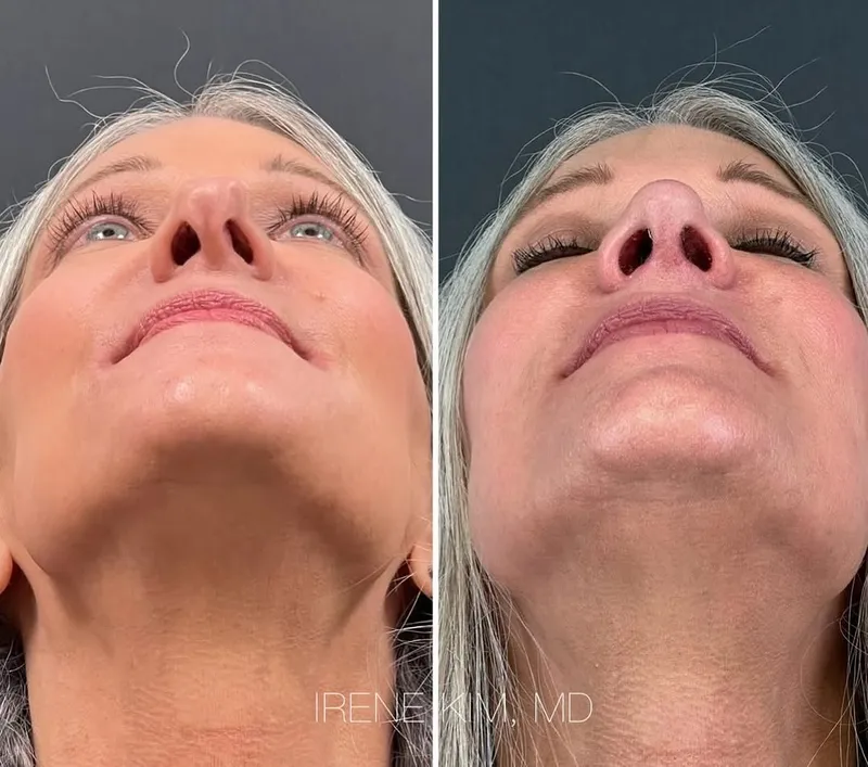 Before and after — Dr. Irene A. Kim