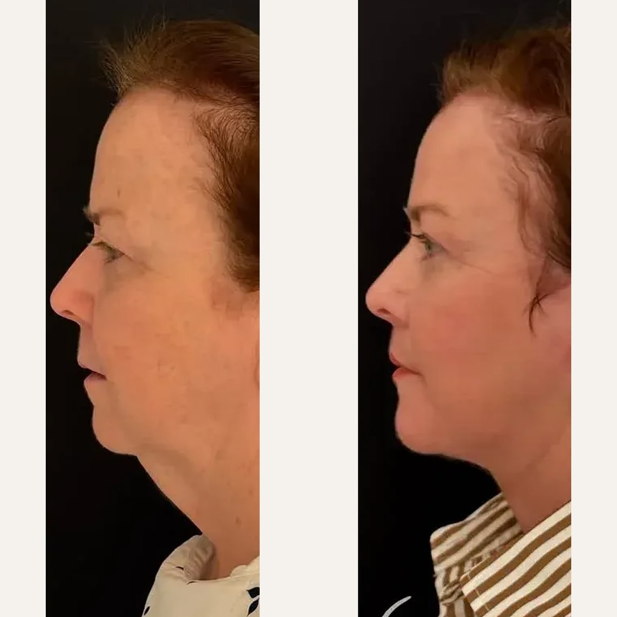 Before and after: Dr. Todd Hanna