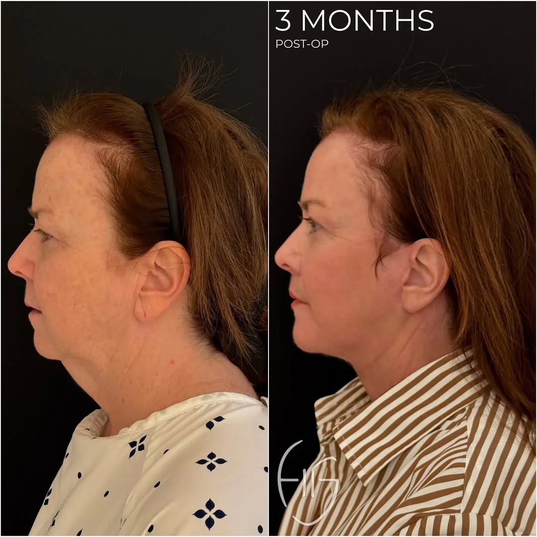 Before and after: Dr. Todd Hanna