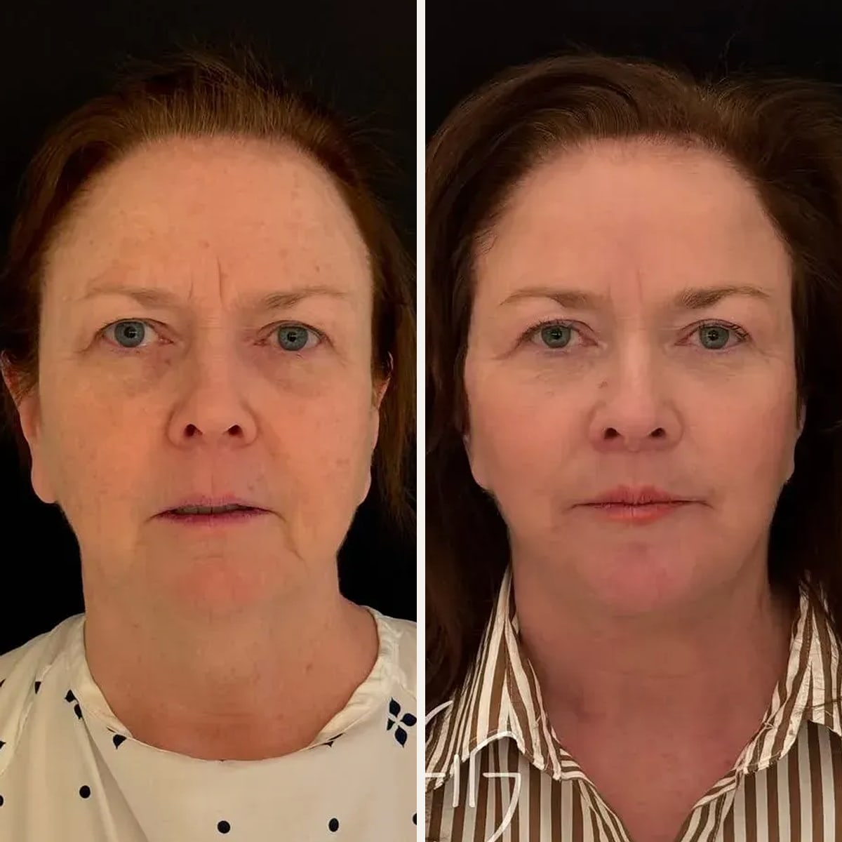 Before and after: Dr. Todd Hanna