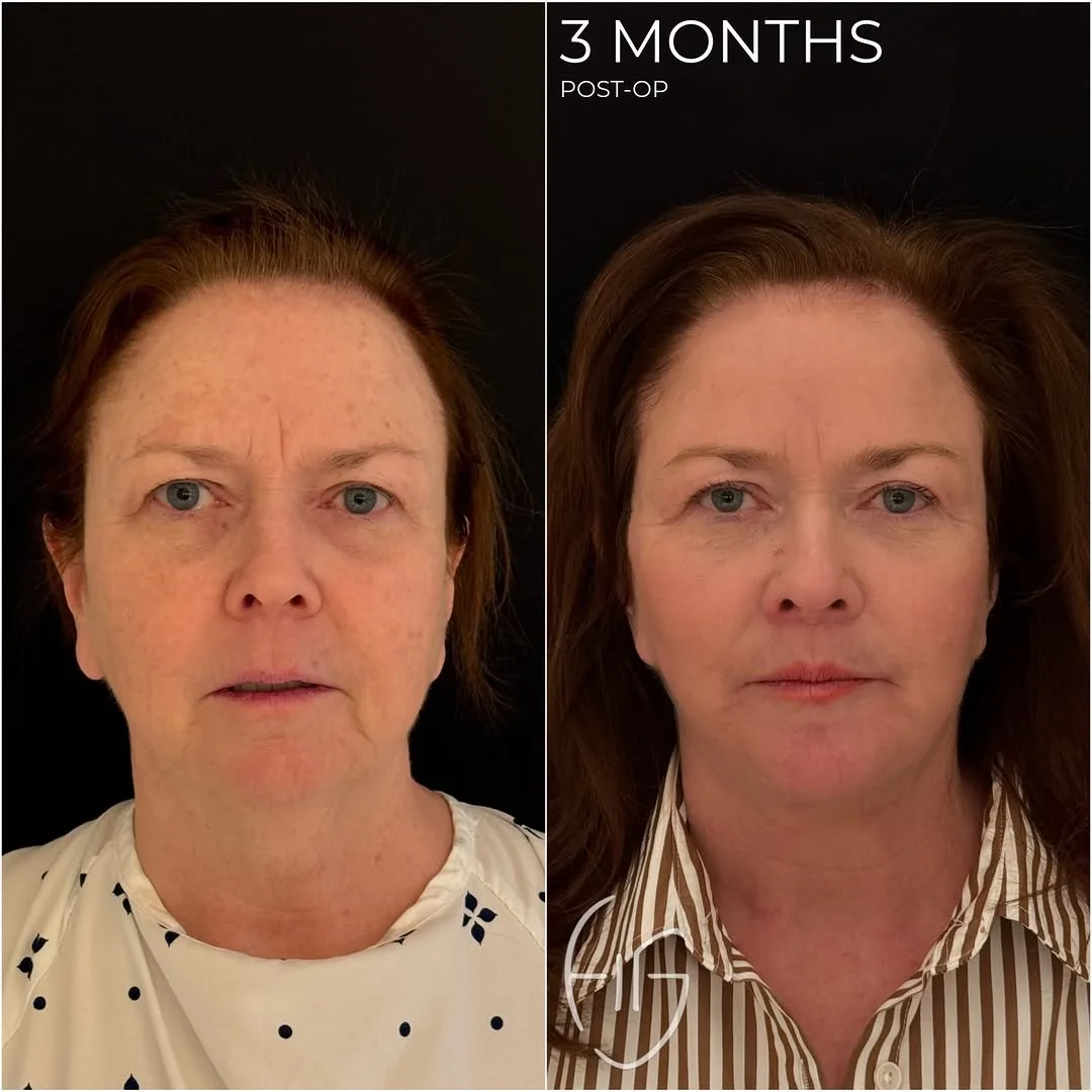 Before and after: Dr. Todd Hanna