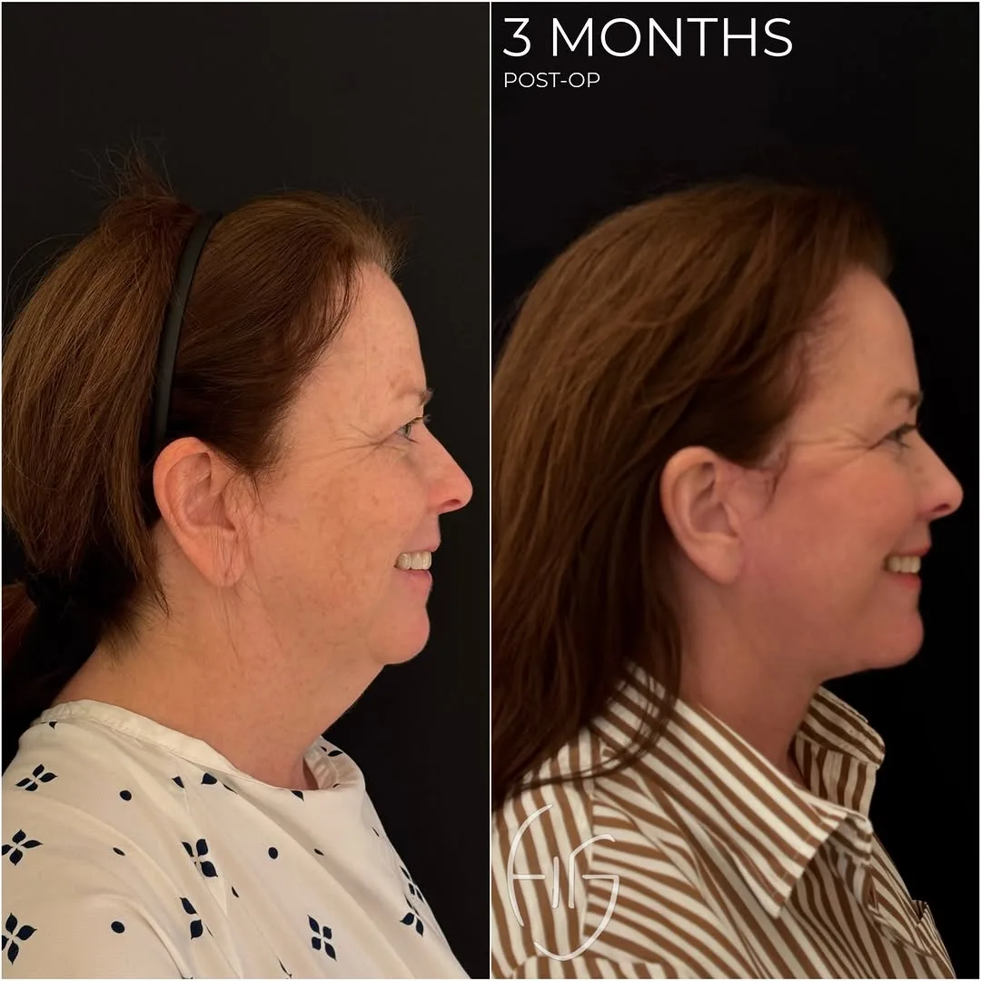 Before and after: Dr. Todd Hanna