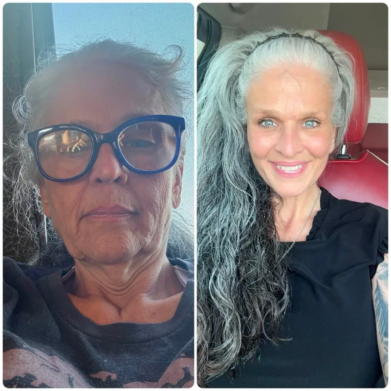 Before and after: Dr. Israel Espino