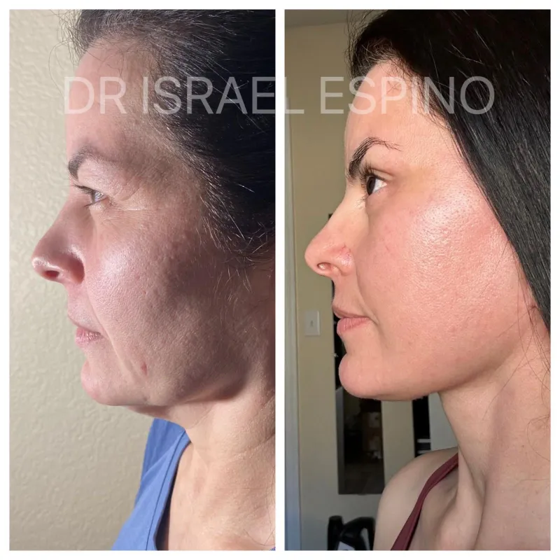 Before and after: Dr. Israel Espino