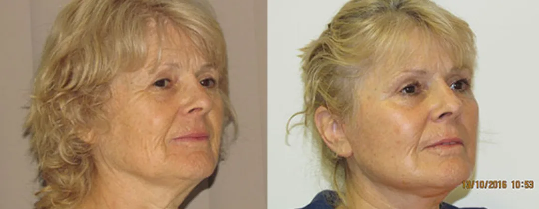 Before and after: Dr. Ivor Gwanmesia