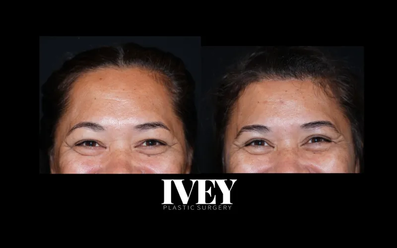 Before and after: Dr. J. Simon Ivey