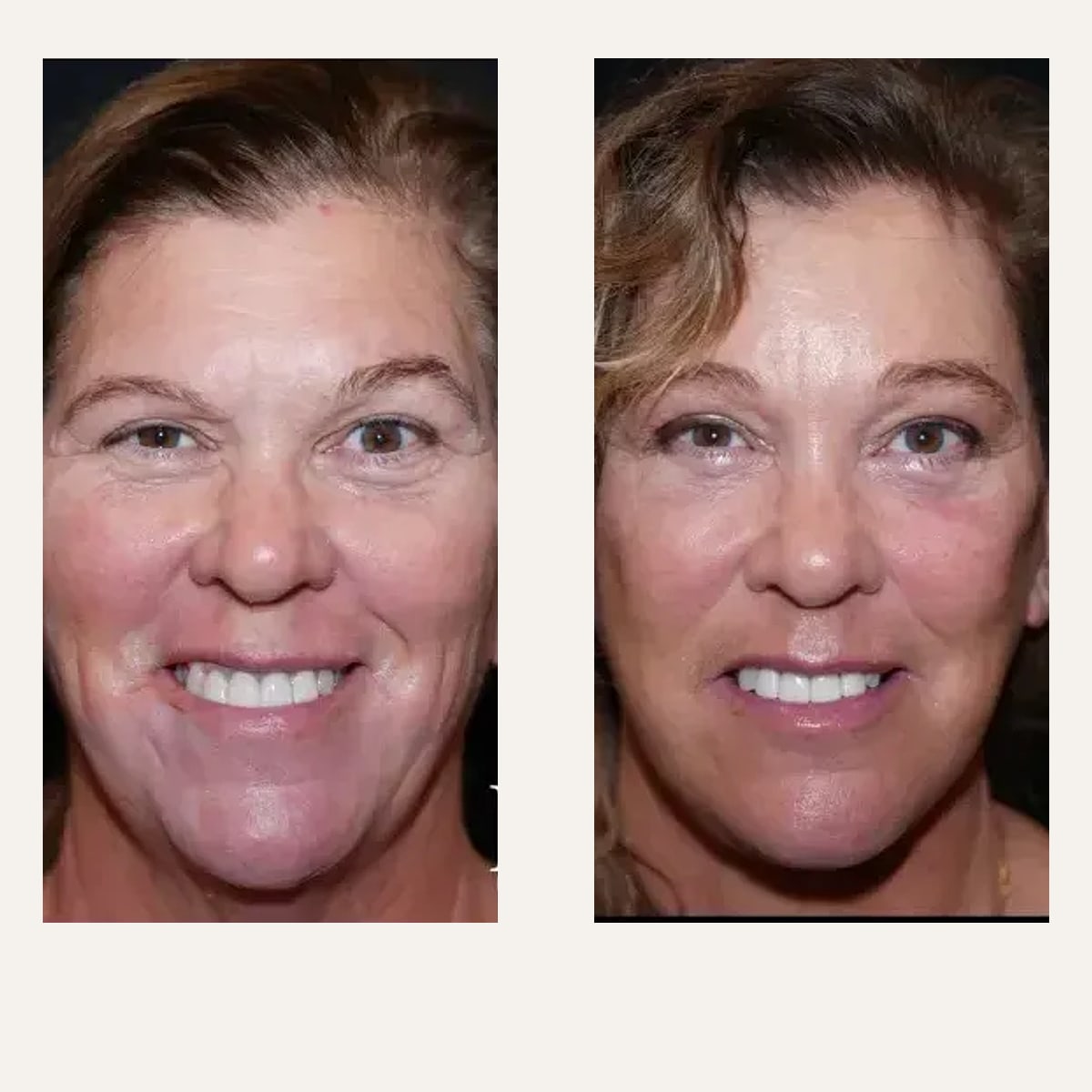 Before and after: Dr. J. Simon Ivey