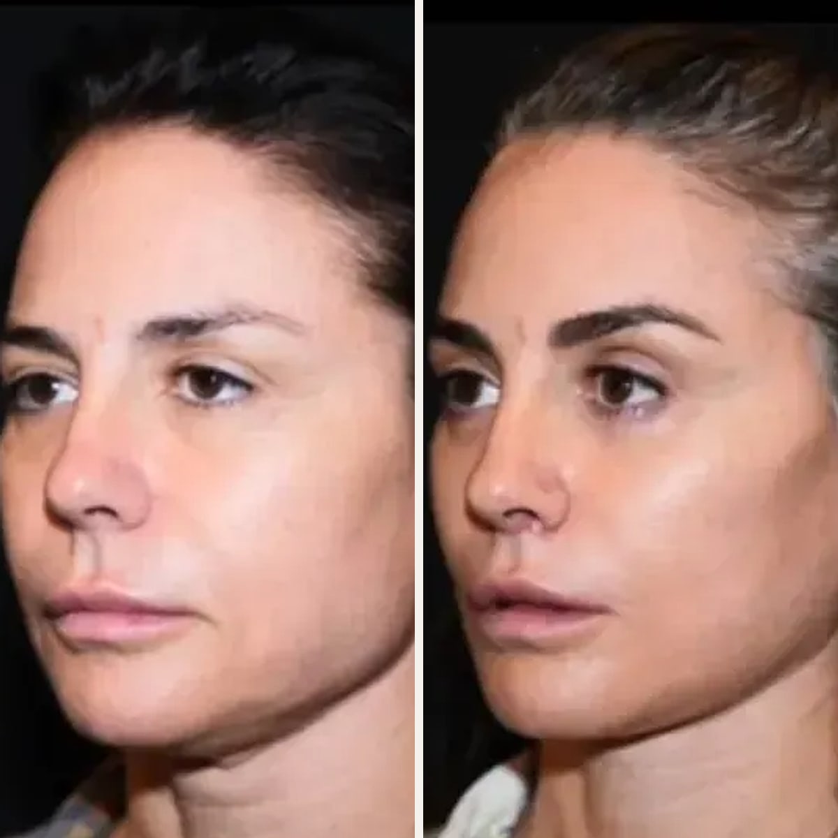 Before and after: Dr. J. Simon Ivey