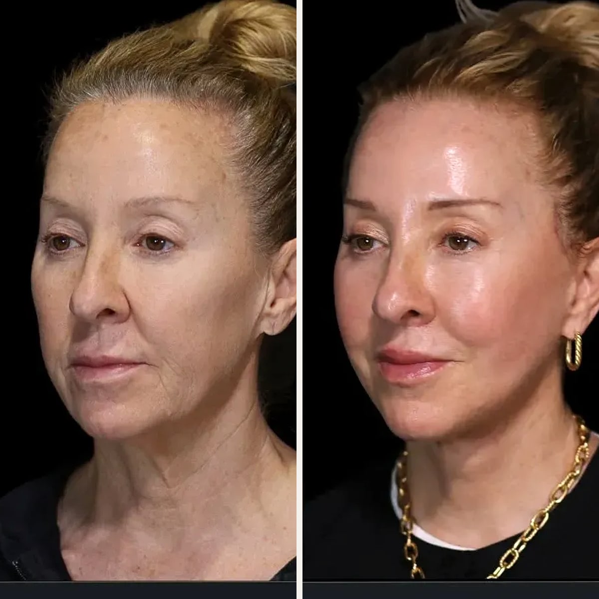 Before and after: Dr. Jack Kolenda