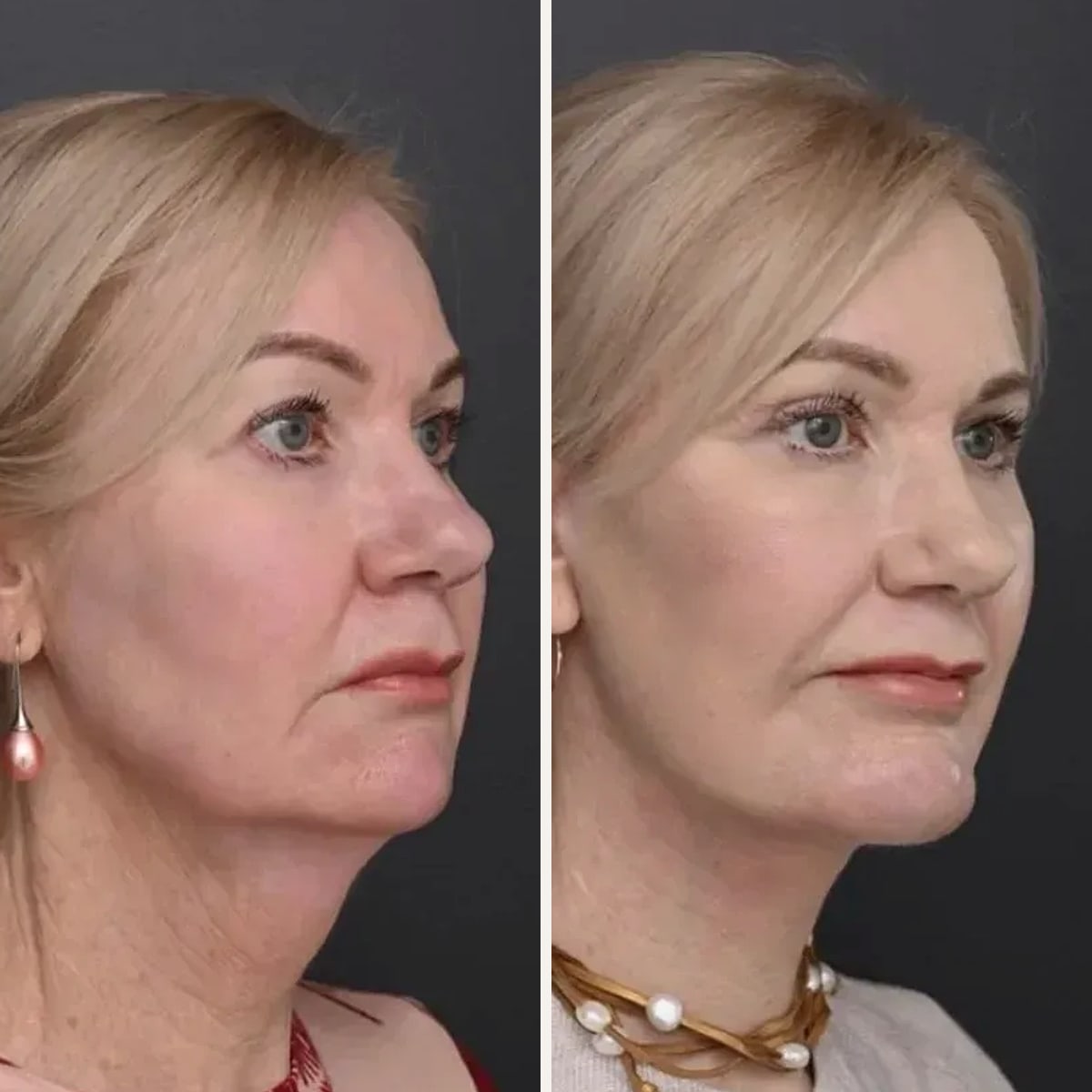 Before and after: Dr. Jack Zoumaras
