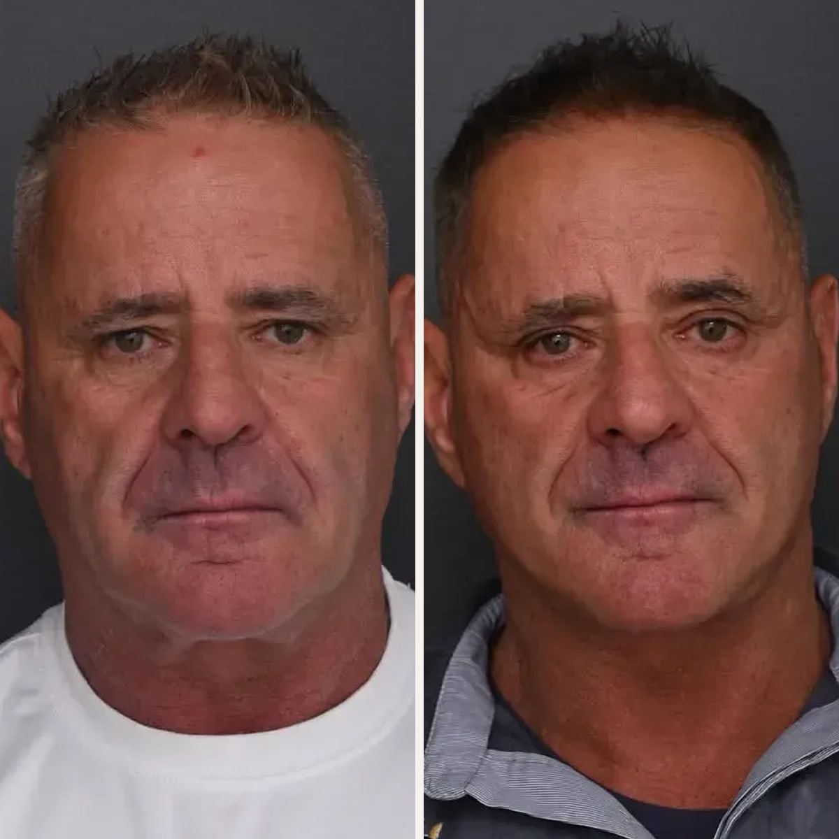 Before and after: Dr. Jack Zoumaras