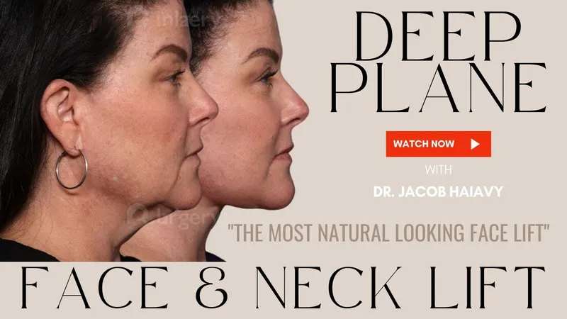 Before and after — Dr. Jacob Haiavy