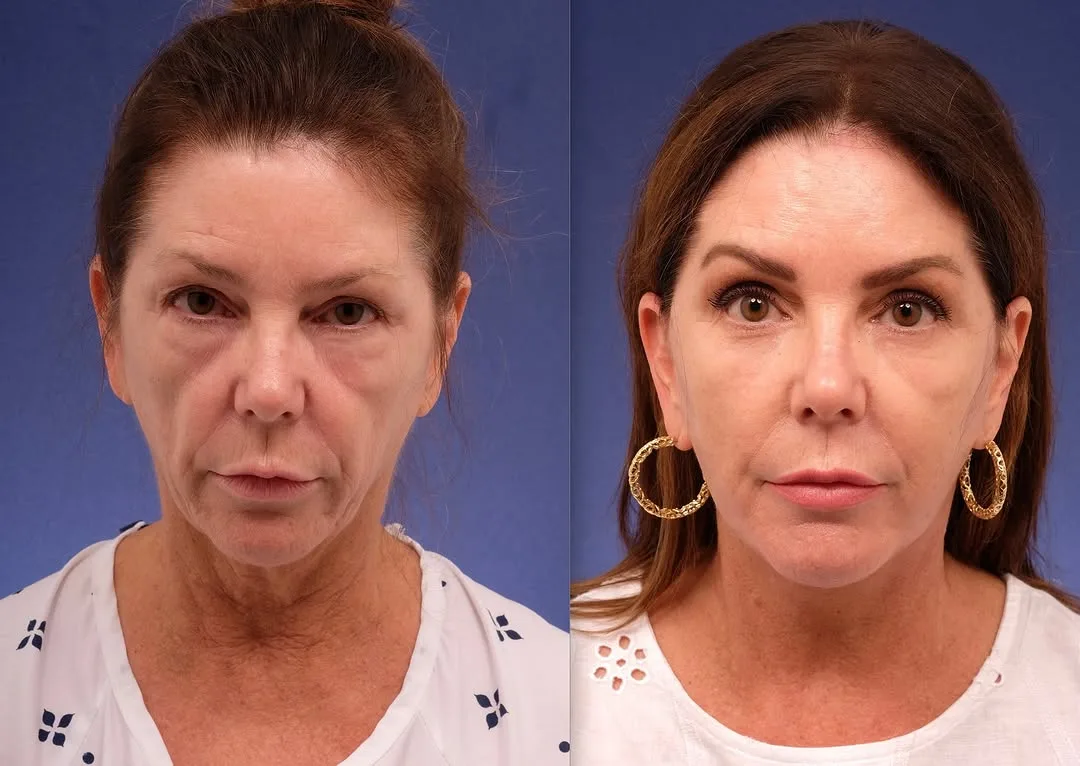 Before and after — Dr. Jacob Steiger