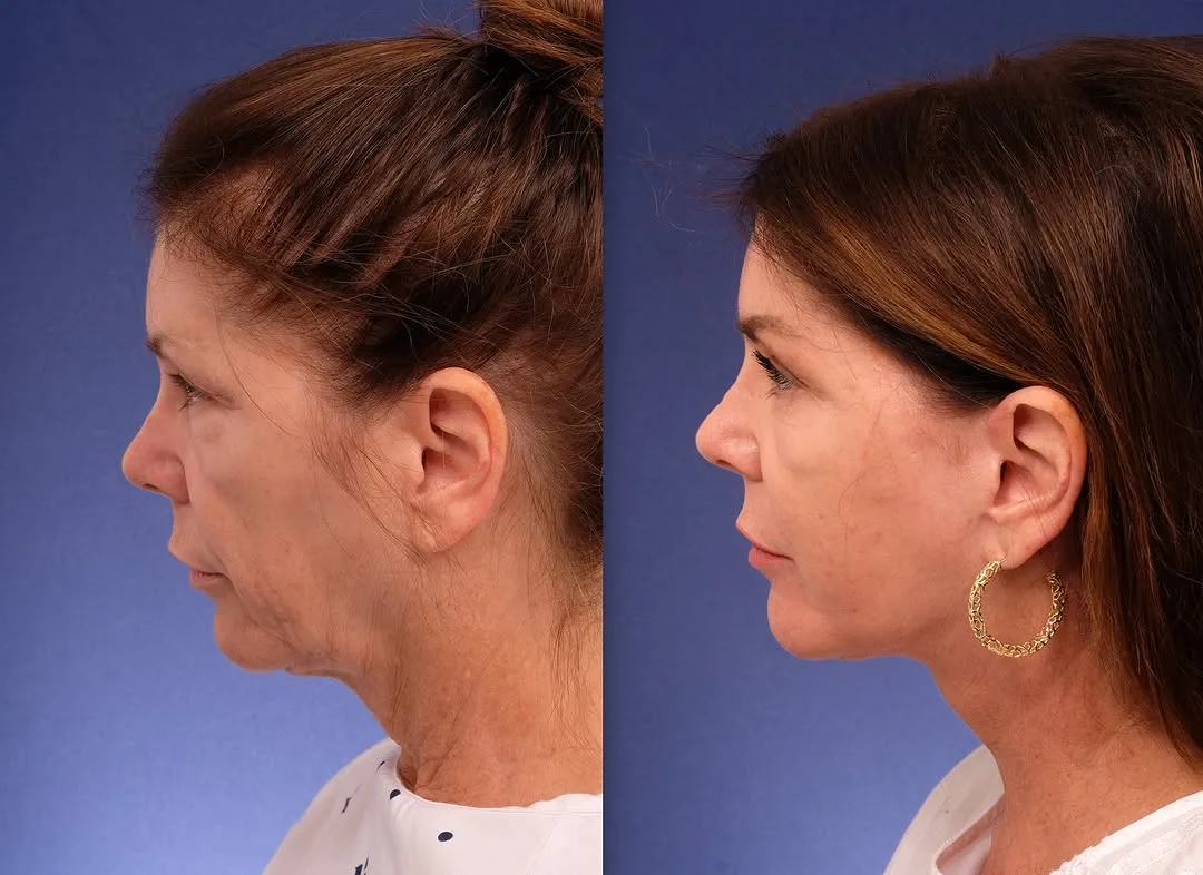 Before and after — Dr. Jacob Steiger