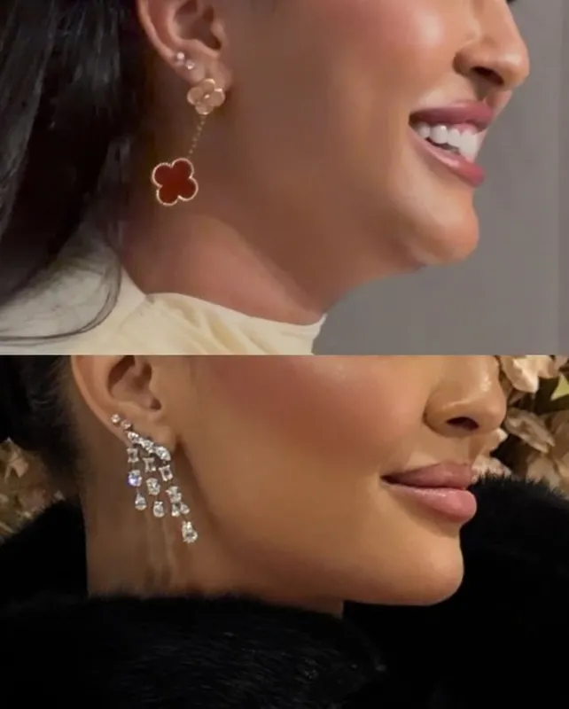 Before and after — Dr. Jad Jabak