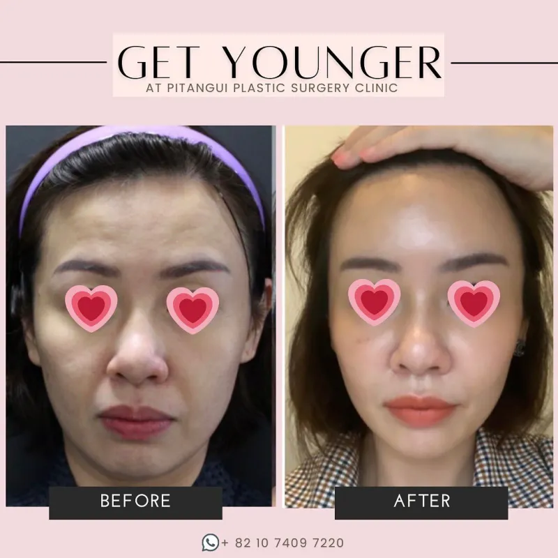 Before and after: Dr. Jae-Sung Yoo
