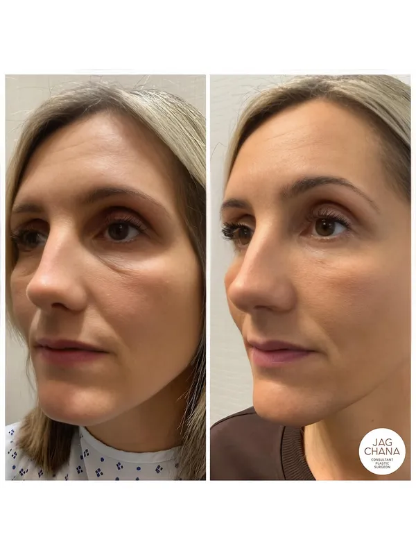 Before and after — Dr. Jag Chana