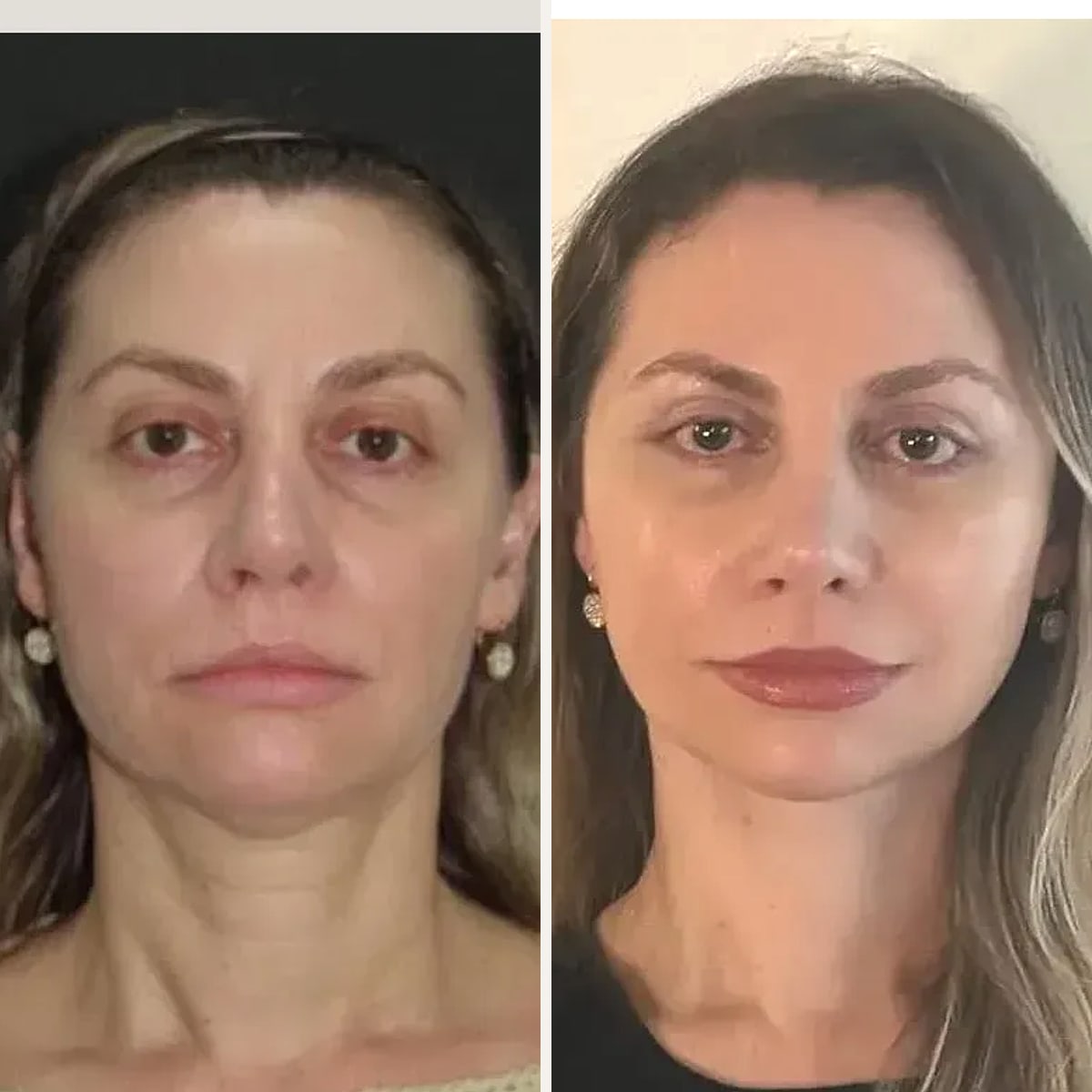 Before and after: Dr. Jair Maciel