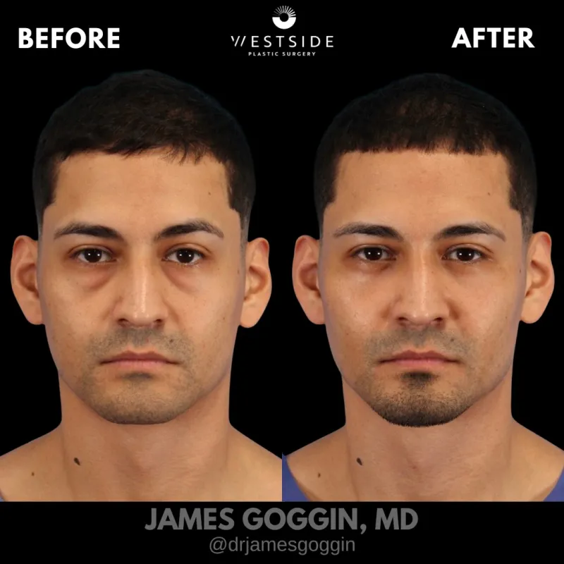 Voor en na: Dr. James Goggin
