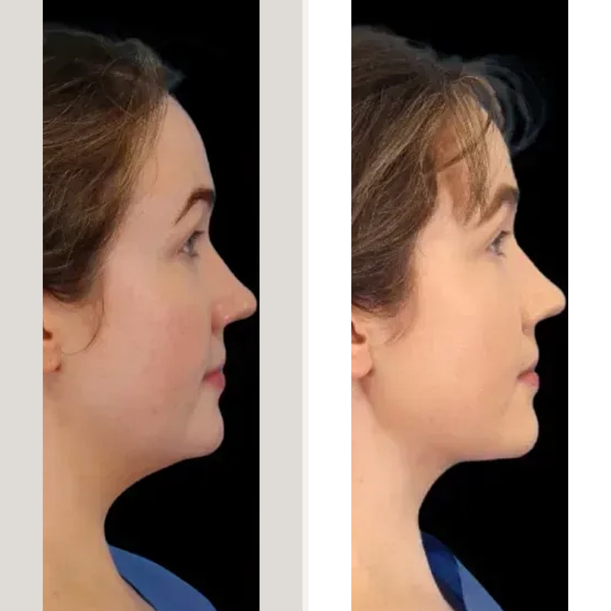 Voor en na: Dr. James Goggin