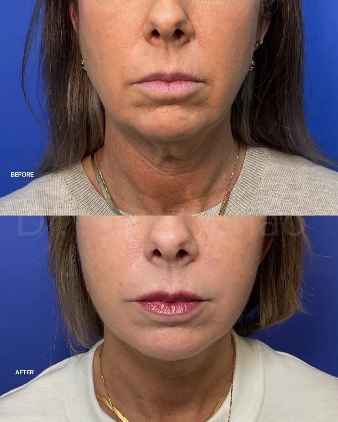 Before and after — Dr. Janet Chao