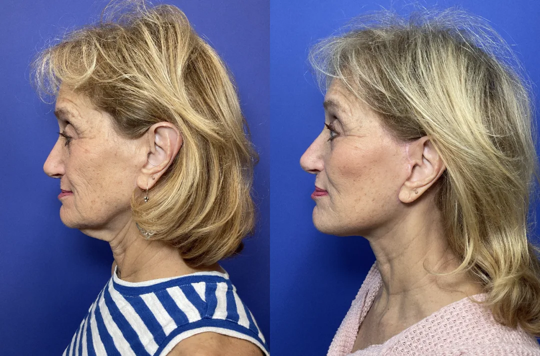 Before and after — Dr. Janet Chao