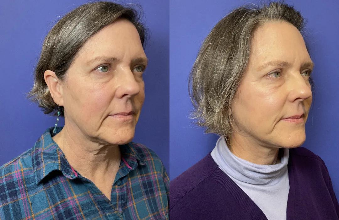 Before and after — Dr. Janet Chao