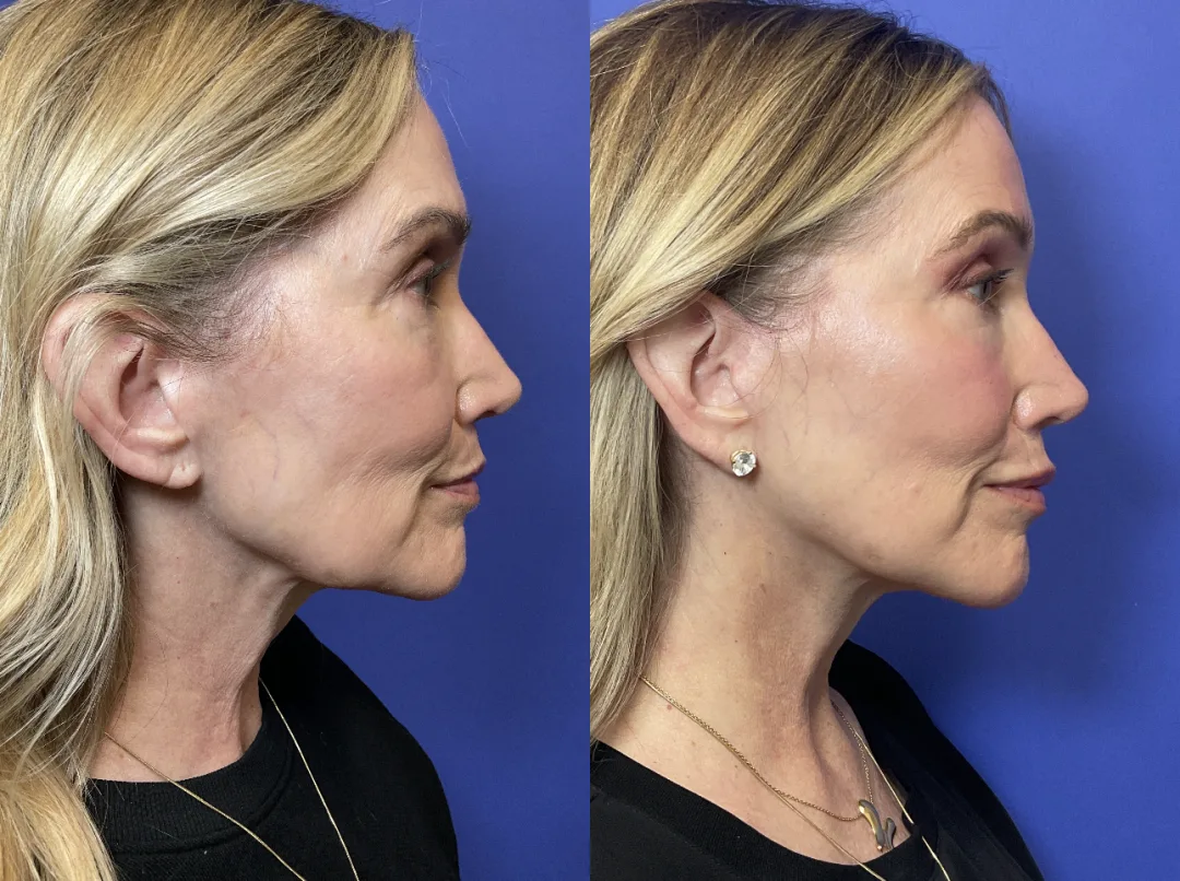 Before and after — Dr. Janet Chao