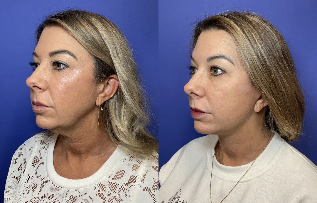 Before and after — Dr. Janet Chao