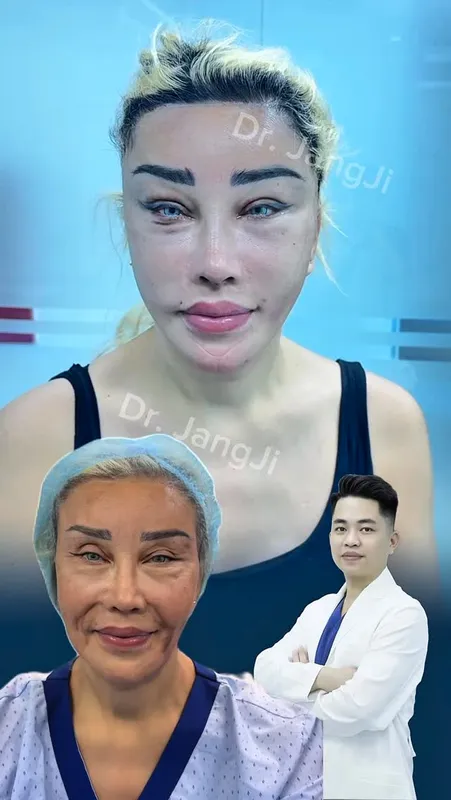 Before and after — Dr. Jang Ji Yeon