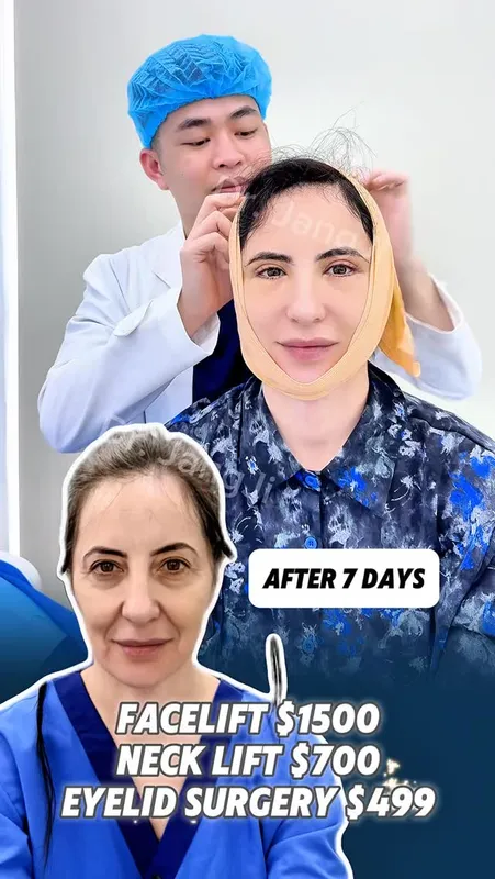 Before and after — Dr. Jang Ji Yeon