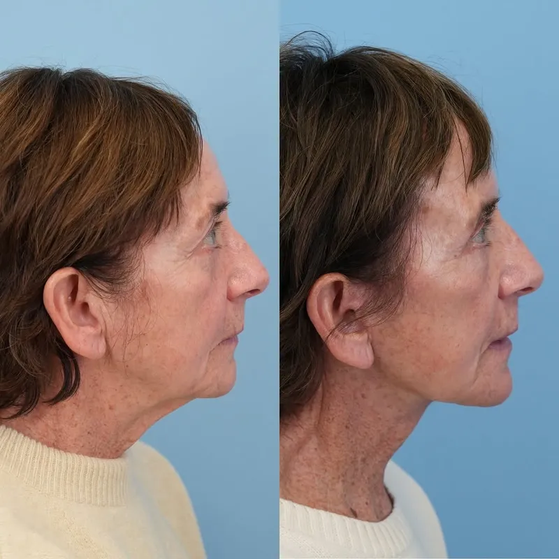 Before and after — Dr. Jason Bloom