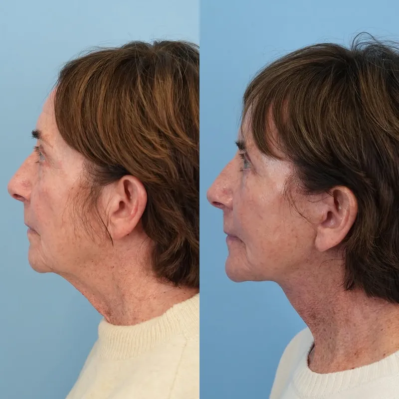 Before and after — Dr. Jason Bloom