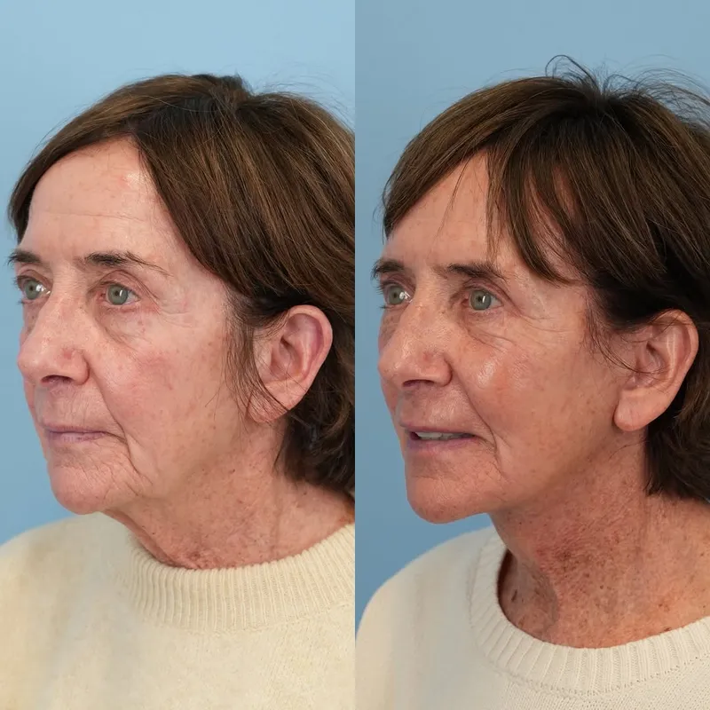 Before and after — Dr. Jason Bloom