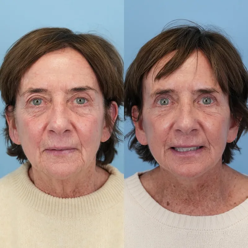 Before and after — Dr. Jason Bloom