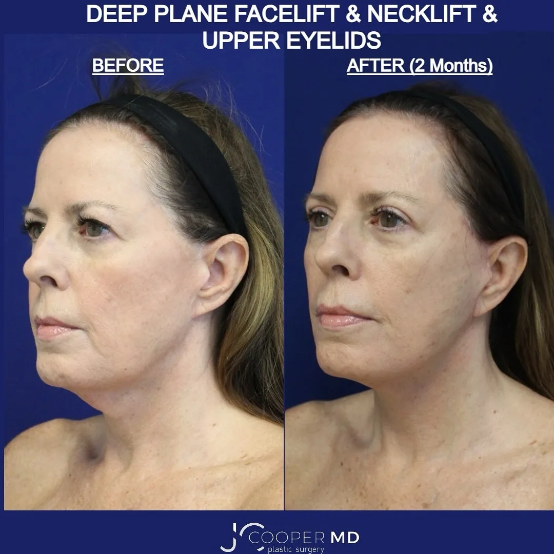 Before and after — Dr. Jason Cooper