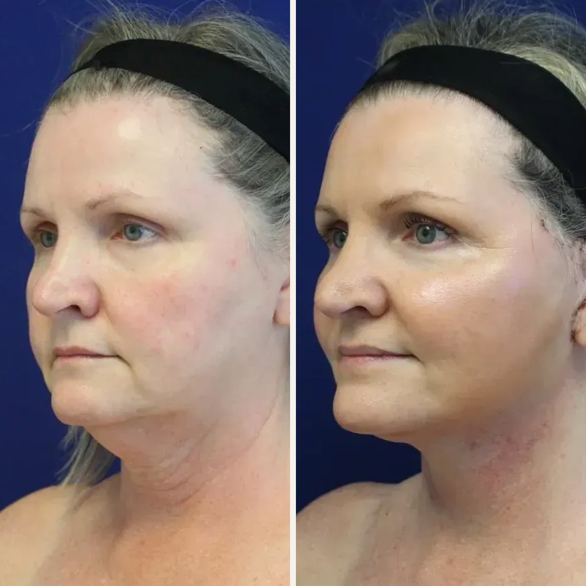 Before and after: Dr. Jason Cooper