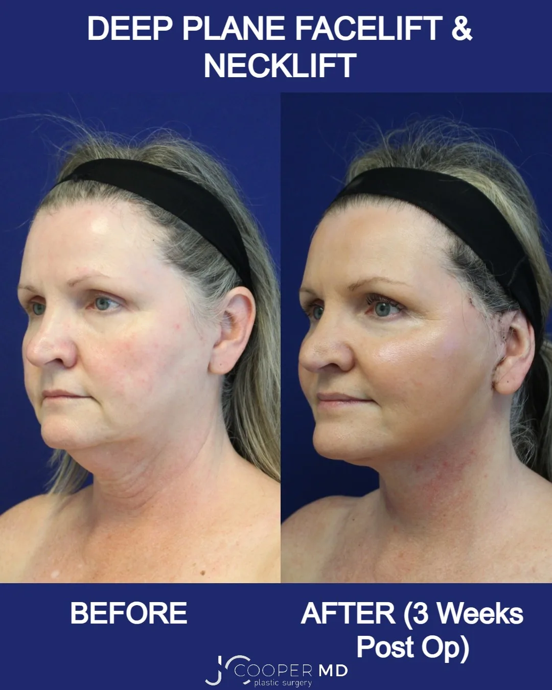 Before and after — Dr. Jason Cooper