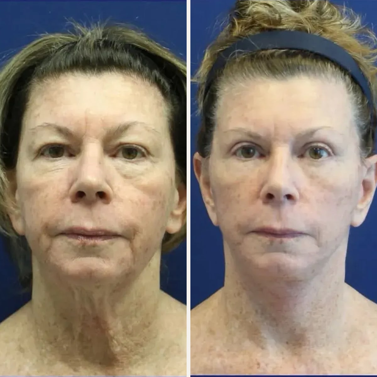 Before and after: Dr. Jason Cooper