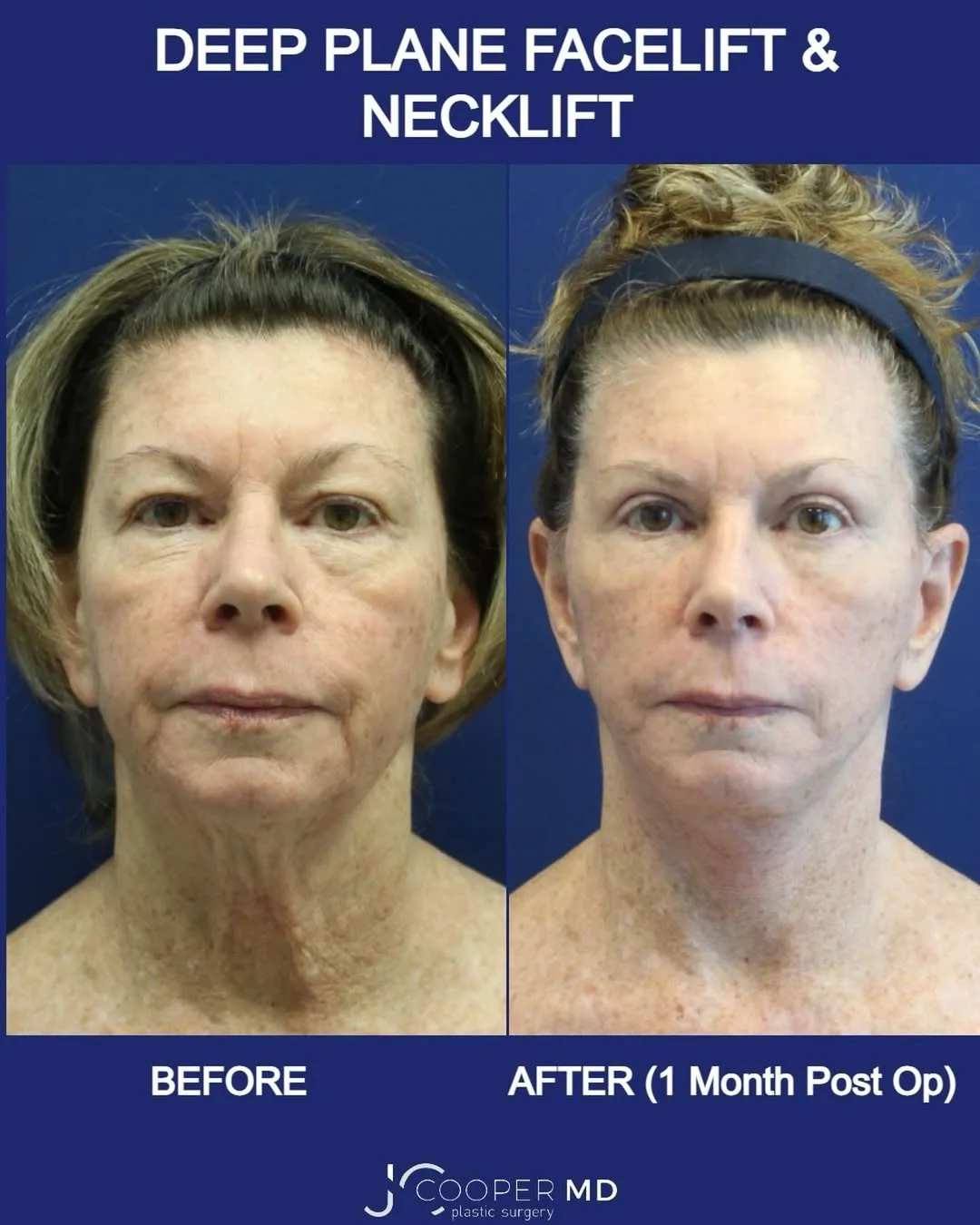 Before and after — Dr. Jason Cooper