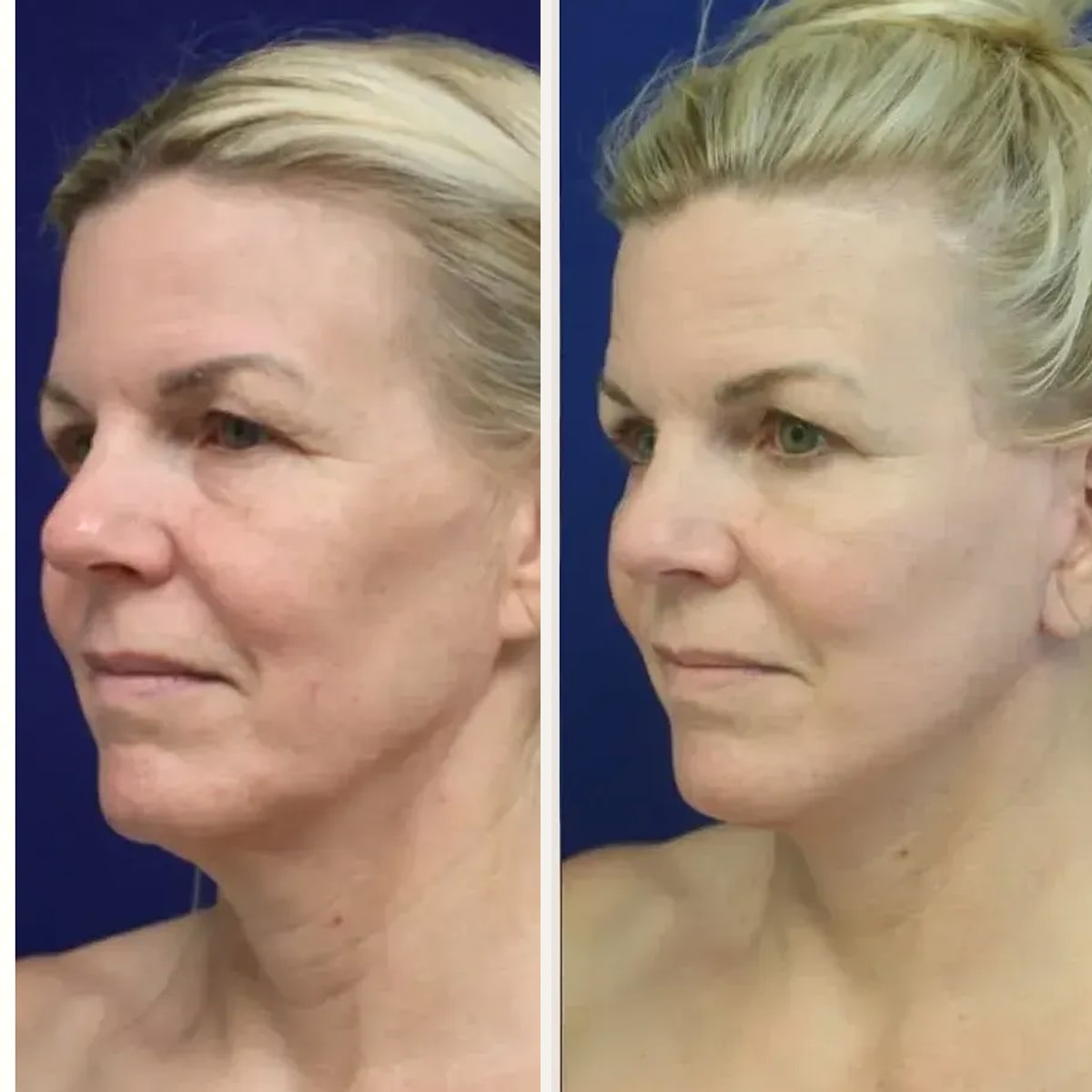 Before and after: Dr. Jason Cooper