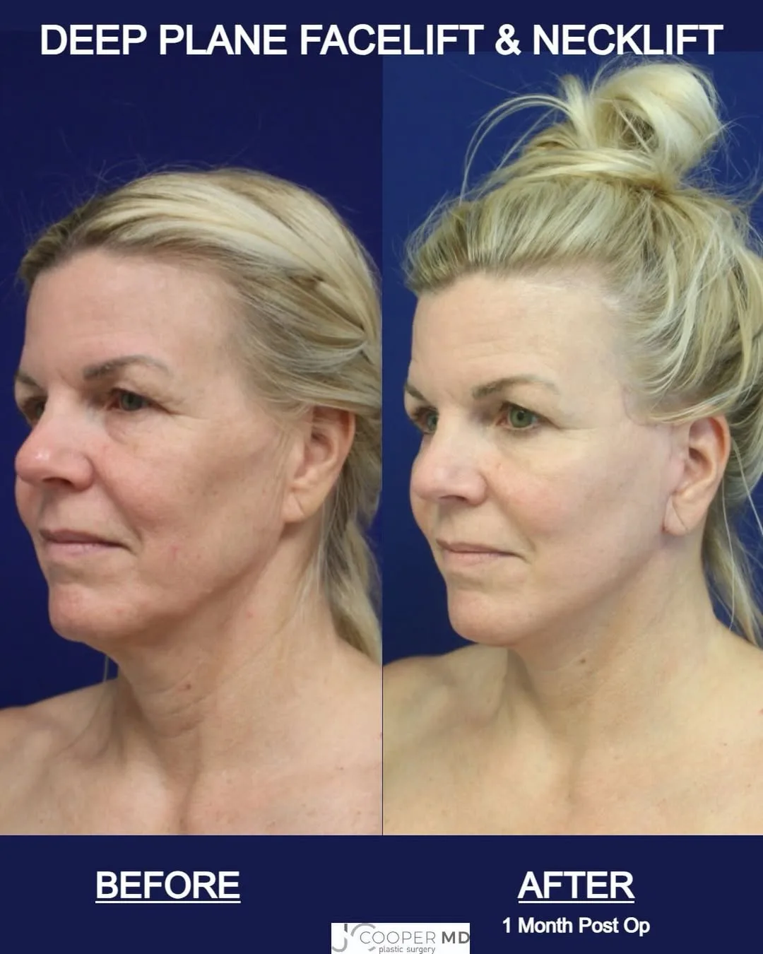 Before and after — Dr. Jason Cooper