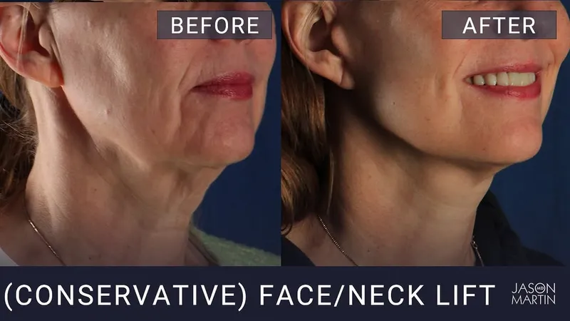 Before and after — Dr. Jason Martin