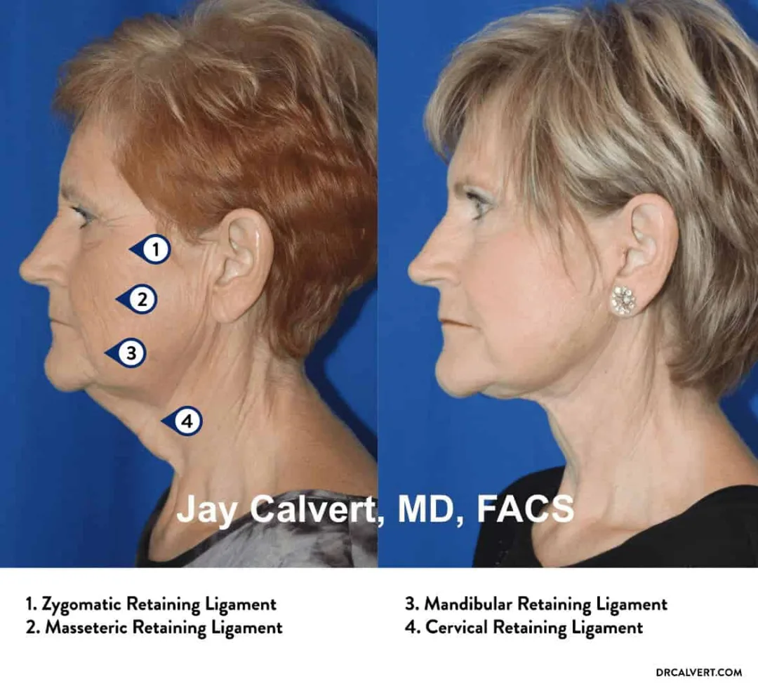 Before and after — Dr. Jay Calvert