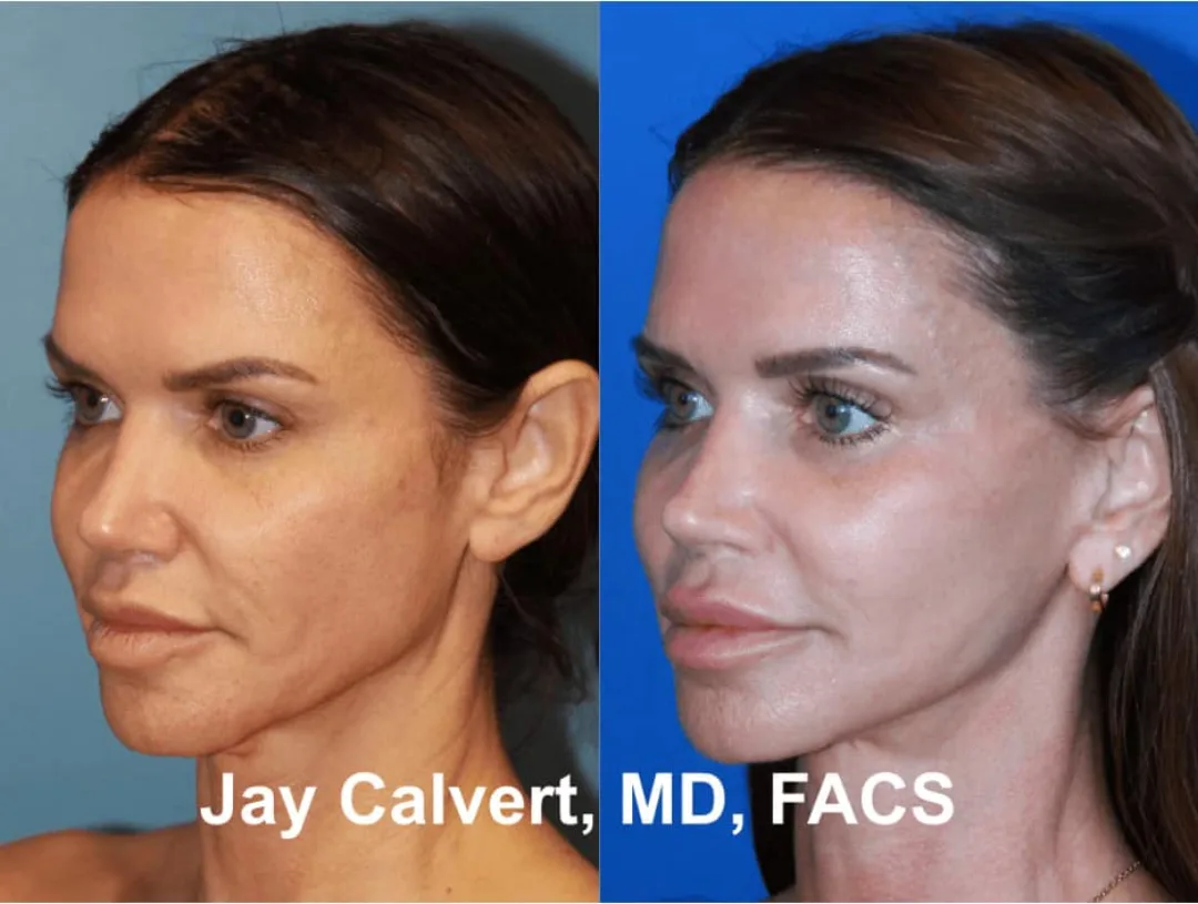 Before and after — Dr. Jay Calvert