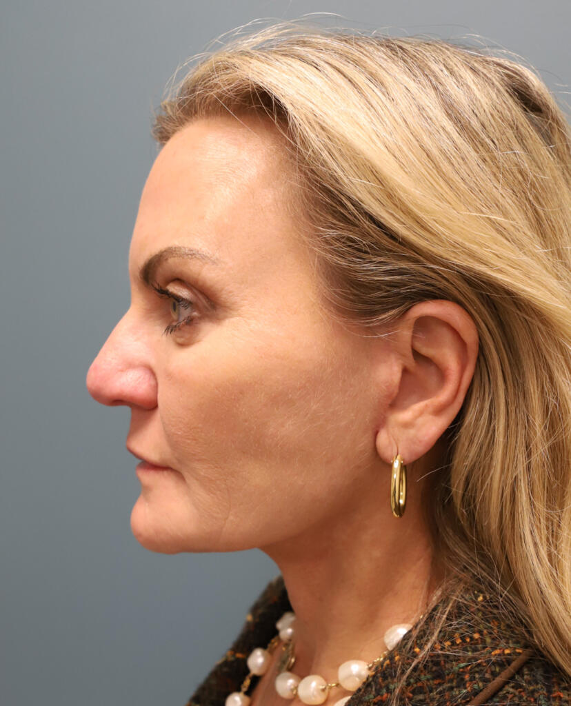 Before and after: Dr. Jay Lucas