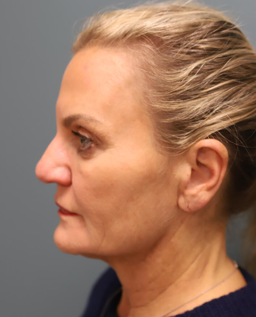 Before and after — Dr. Jay Lucas
