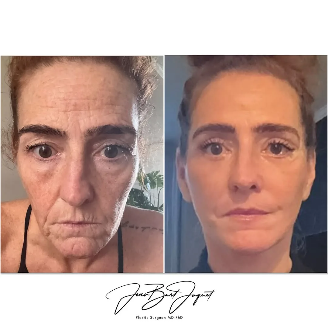 Before and after: Dr. Jean-Bart Jaquet