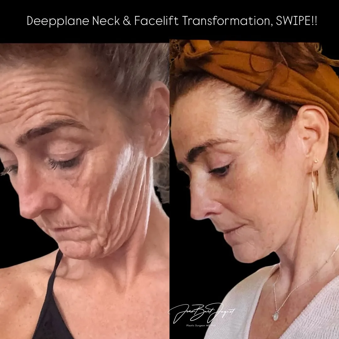 Before and after — Dr. Jean-Bart Jaquet