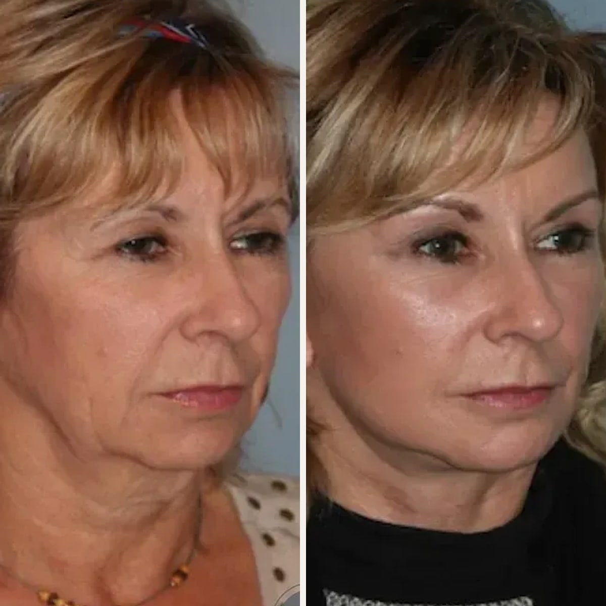 Before and after: Dr. Jed Horowitz